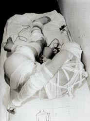 Rudolf Schwarzkogler