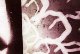 Immagine sintetizzata