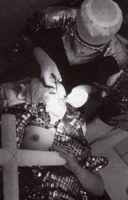 Orlan durante una delle operazioni di plastica